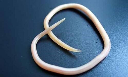 Wie man das Vorhandensein von Parasiten bestimmt